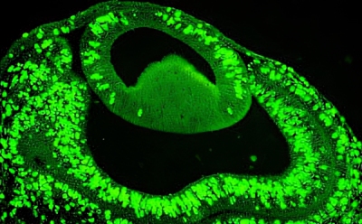 Proliferating cells in the eye of E4 chick embryo using BrdU staining 使用 BrdU 染色法检测 E4 小鸡胚胎眼球中的增殖细胞