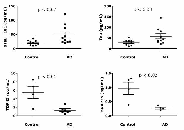 High Sensitivity Analysis of Neurodegenerative Disease Biomarkers 通过SMC®超灵敏免疫检测试剂盒测定神经退行性疾病生物标志物磷酸化Tau蛋白(T181)、总Tau蛋白、TDP-43和SNAP-25的浓度。