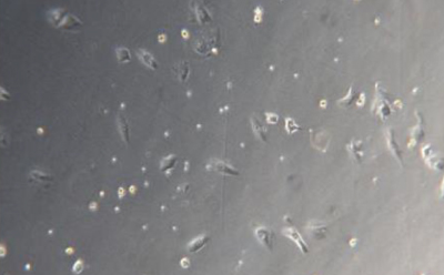 Kupffer C Microscopy image of Kupffer cells at 48 hours. Light grey square with small dark grey dots and small rectangles that indicate cells.