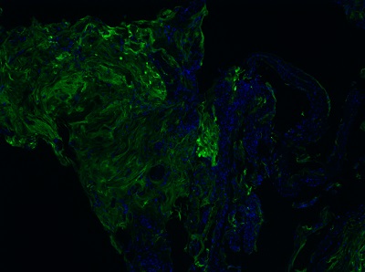 Purified Antibodies Purified antibodies improve the accuracy of spatial biology research by delivering dependable data on cellular interactions within tissues.