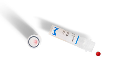 Vitroids™ 和 LENTICULE® 菌片位于右侧小瓶外和左侧旋盖密封圈内。