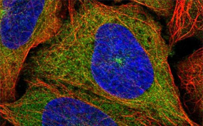 兔抗 KIF5B Prestige® 抗体。经过高度鉴定和验证的 Prestige Antibodies®。