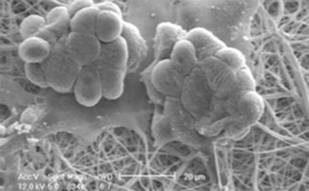 Cells Grown Nanofiber Structural Insert 扫描电子显微镜图像,描绘了粘附在纤维网络上的微生物细胞群,以单色显示,用于详细纹理分析。