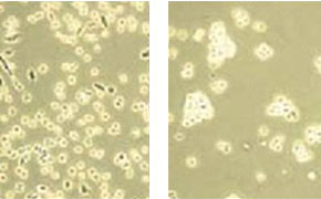 The image presents a comparative microscopic view of cells, with the left section showing a dense cluster of small, irregularly shaped cells, and the right section displaying larger, more defined cells that are sparser in distribution. 
