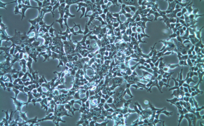 Cryo-DMSO-F Confluency HEK-293T 细胞的显微图像。四角有大尖峰的矩形代表细胞覆盖了整个图像。