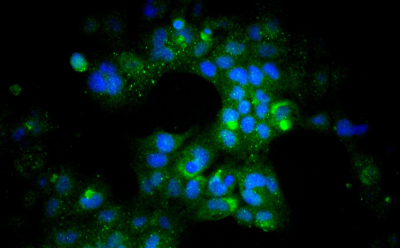 hl-1 mouse cardiac muscle cells 在 HL-1 筛选的 FBS 存在下,核周 ANF(绿色)和核 DAPI(蓝色)的荧光网染色