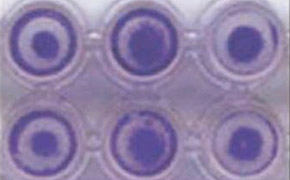 A close-up image of a 96-well plate with each well containing HT-1080 cells with a distinct darker circular pattern in the center. The wells are arranged in two rows of three.