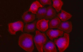 UFH-001 Human Triple Negative Breast Cancer Cells UFH-001 人类乳腺癌细胞的荧光染色