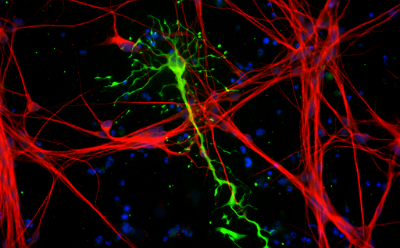 Cortical Astrocytes 神经元线条覆盖图像两侧,中间延伸出一条星形胶质细胞的长线。该细胞顶端带有小圆圈,标示其细胞体,并有更细小的线条从细胞体向外辐射。