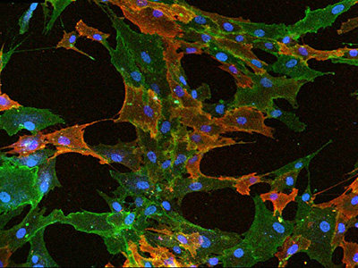 Fluorescent ICC staining of mesenchymal stem cells 间充质干细胞荧光染色免疫细胞化学法