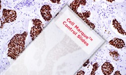 Cell Marque™ control slides for IHC staining IHC staining micrograph from a Cell Marque™ control slide