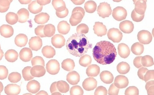 Hematology Stains
