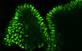 类器官 荧光染色类器官的显微图像