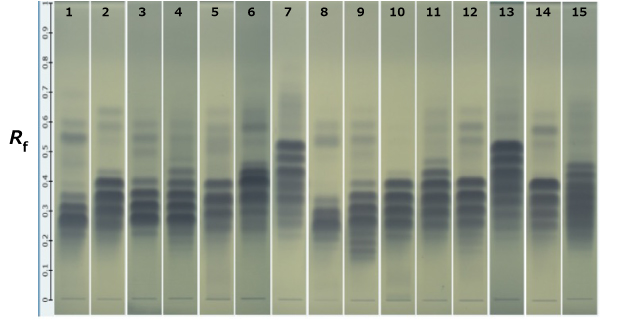 HPTLC bands of different oils. HPTLC bands of blue color in varying intensities obtained for 15 different oils on a Silica Gel 60 RP18 F254 plates kept next to each other, labeled 1 to 15 from left to right.