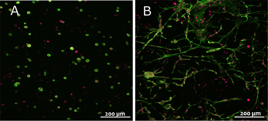 3T3 fibroblasts in TrueGel3D™ hydrogels 3T3 fibroblasts in TrueGel3D™ hydrogels