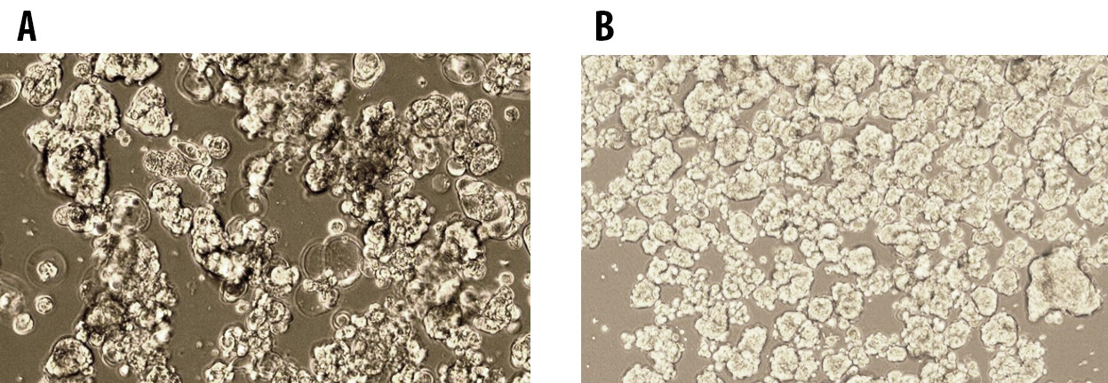 Tumorsphere formation of MCF7 Breast Cancer Cells at Passage Tumorsphere formation of MCF7 Breast Cancer Cells at Passage