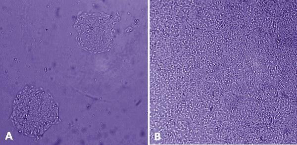 MaxGel™ ECM enables improved expansion of adult keratinocytes. MaxGel™ ECM enables improved expansion of adult keratinocytes.