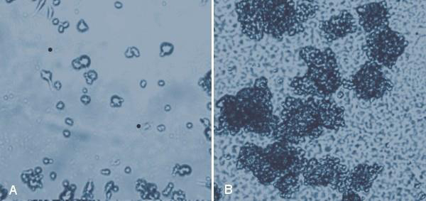 MaxGel™ ECM provides an excellent substrate for neural stem cells. MaxGel™ ECM provides an excellent substrate for neural stem cells.