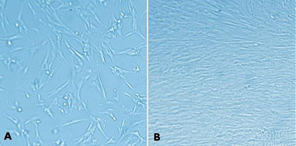 MaxGel™ ECM enables improved expansion of MRC-5 cells. MaxGel™ ECM enables improved expansion of MRC-5 cells.