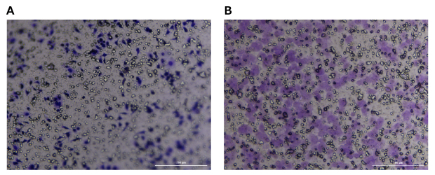 Crystal violet staining of Millicell® inserts