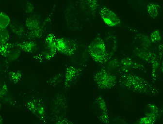 活细胞LC3慢病毒荧光生物传感器 活细胞LC3慢病毒荧光生物传感器