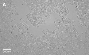 millicell-cell-lines-12022001-a Brightfield imaging of HEK 293T cells on Millicell<sup>®</sup> DCI Digital Cell Imager at 10X magnification