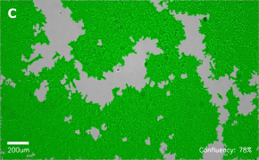 millicell-cell-lines-12022001-c Brightfield imaging of HEK 293T cells on Millicell<sup>®</sup> DCI Digital Cell Imager at 10X magnification with mask