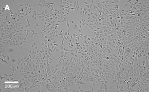 millicell-cell-lines-84100401-a Brightfield imaging of MRC-5 Sv2 cells on Millicell<sup>®</sup> DCI Digital Cell Imager at 10X magnification
