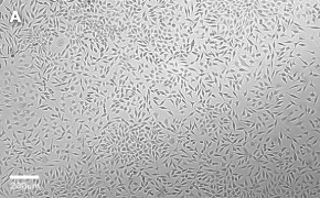 millicell-cell-lines-85011425-a Brightfield imaging of L929 cells on Millicell<sup>®</sup> DCI Digital Cell Imager at 10X magnification