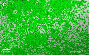 millicell-cell-lines-85011425-c Brightfield imaging of L929 cells on Millicell<sup>®</sup> DCI Digital Cell Imager at 10X magnification with mask