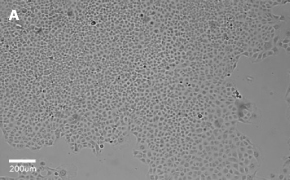 millicell-cell-lines-85020206-a Brightfield imaging of C1008 cells on Millicell<sup>®</sup> DCI Digital Cell Imager at 10X magnification