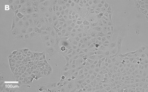 millicell-cell-lines-85020206-b Brightfield imaging of T24T cells on Millicell<sup>®</sup> DCI Digital Cell Imager at 20X magnification