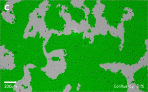 millicell-cell-lines-85090402-c Brightfield imaging of A431 cells on Millicell<sup>®</sup> DCI Digital Cell Imager at 10X magnification with mask