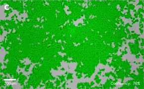 millicell-cell-lines-86012803-c Brightfield imaging of MCF-7 cells on Millicell<sup>®</sup> DCI Digital Cell Imager at 10X magnification with mask