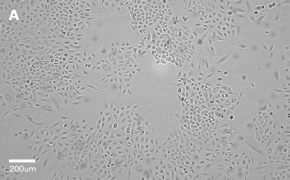 millicell-cell-lines-86012804-a Brightfield imaging of A549 cells on Millicell<sup>®</sup> DCI Digital Cell Imager at 10X magnification