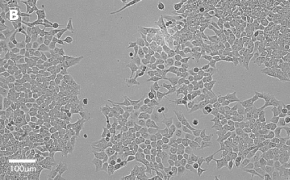millicell-cell-lines-91091005-b Brightfield imaging of HCT116 cells on Millicell<sup>®</sup> DCI Digital Cell Imager at 20X magnification