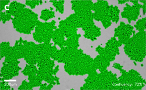 millicell-cell-lines-91091005-c Brightfield imaging of HCT116 cells on Millicell<sup>®</sup> DCI Digital Cell Imager at 10X magnification with mask