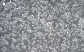 ALMC-1 cells imaged on Millicell® DCI Digital Cell Imager Brightfield imaging of ALMC-1 cells on Millicell<sup>®</sup> DCI Digital Cell Imager at 10X magnification