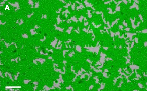 OSUMMER.10 cells imaged on Millicell<sup>®</sup> DCI Digital Cell Imager Brightfield imaging of OSUMMER.10 cells on Millicell<sup>®</sup> DCI Digital Cell Imager at 10X magnification