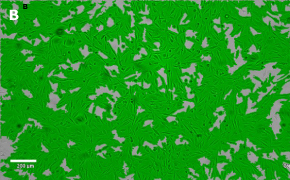 Masked OSUMMER.2 cells on Millicell<sup>®</sup> DCI Digital Cell Imager Brightfield imaging of OSUMMER.2 cells on Millicell<sup>®</sup> DCI Digital Cell Imager at 10X magnification with mask