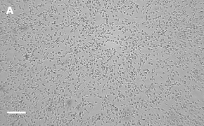 OSUMMER.3 cells imaged on Millicell<sup>®</sup> DCI Digital Cell Imager Brightfield imaging of OSUMMER.3 cells on Millicell<sup>®</sup> DCI Digital Cell Imager at 10X magnification
