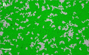 Masked OSUMMER.3 cells on Millicell<sup>®</sup> DCI Digital Cell Imager Brightfield imaging of OSUMMER.3 cells on Millicell<sup>®</sup> DCI Digital Cell Imager at 10X magnification with mask