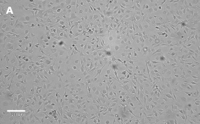OSUMMER.8 cells imaged on Millicell<sup>®</sup> DCI Digital Cell Imager Brightfield imaging of OSUMMER.8 cells on Millicell<sup>®</sup> DCI Digital Cell Imager at 10X magnification