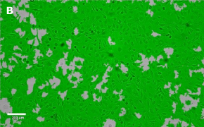 Masked OSUMMER.8 cells on Millicell<sup>®</sup> DCI Digital Cell Imager Brightfield imaging of OSUMMER.8 cells on Millicell<sup>®</sup> DCI Digital Cell Imager at 10X magnification with mask
