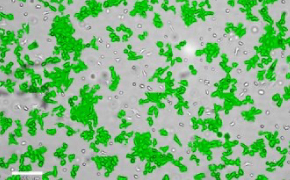 Masked Scp2 cells on Millicell<sup>®</sup> DCI Digital Cell Imager Brightfield imaging of Scp2 cells on Millicell<sup>®</sup> DCI Digital Cell Imager at 10X magnification with mask