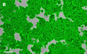 Masked MCF-7 BUS cells on Millicell<sup>®</sup> DCI Digital Cell Imager Brightfield imaging of MCF-7 BUS cells on Millicell<sup>®</sup> DCI Digital Cell Imager at 10X magnification with mask