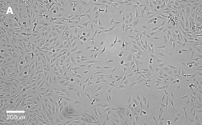 MG-63 cells imaged on Millicell<sup>®</sup> DCI Digital Cell Imager, 10X Brightfield imaging of MG-63 cells on Millicell<sup>®</sup> DCI Digital Cell Imager at 10X magnification
