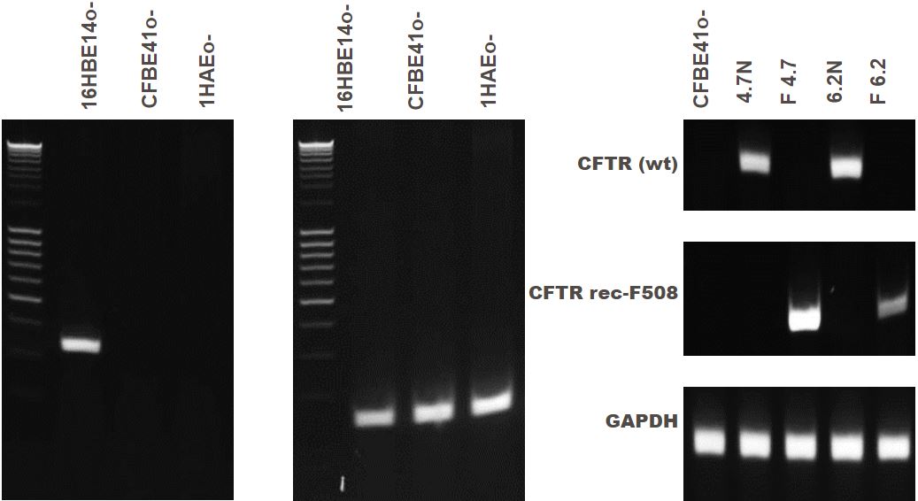 Using Immortalized 16HBE14o- Human Bronchial Epithelial Cell Lines to Model Respiratory Lung Diseases CFTR gene expression of bronchial epithelial cell lines.