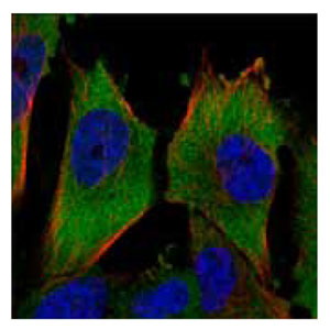 抗-PKM2 抗-PKM2