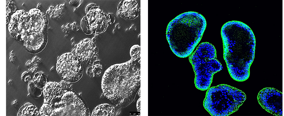 Apical out gut organoids Fluorescent and contrast imaging of apical out gut organoids